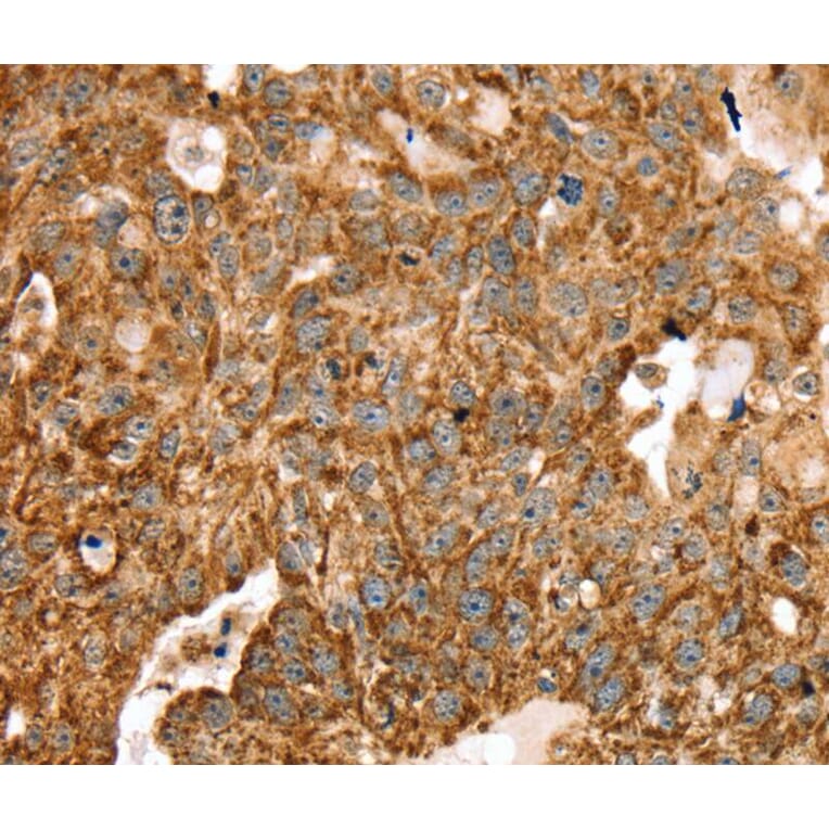 Immunohistochemistry - STK32B Antibody from Signalway Antibody (40227) - Antibodies.com