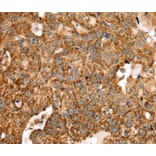 Immunohistochemistry - STK32B Antibody from Signalway Antibody (40227) - Antibodies.com
