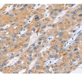 Immunohistochemistry - ERVW-1 Antibody from Signalway Antibody (40230) - Antibodies.com