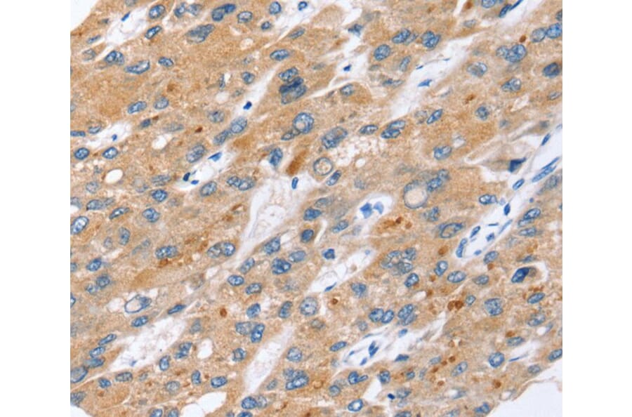 Immunohistochemistry - ERVW-1 Antibody from Signalway Antibody (40230) - Antibodies.com