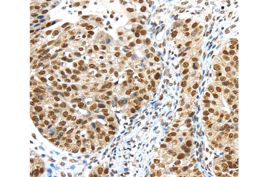 Immunohistochemistry - TRIM33 Antibody from Signalway Antibody (40248) - Antibodies.com