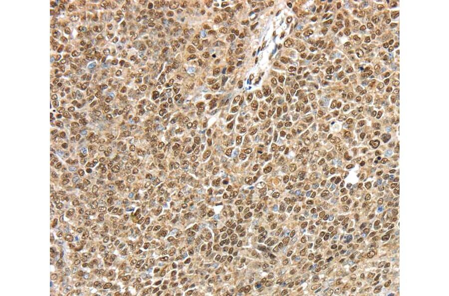 Immunohistochemistry - TRIM33 Antibody from Signalway Antibody (40248) - Antibodies.com