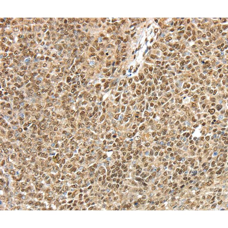 Immunohistochemistry - TRIM33 Antibody from Signalway Antibody (40248) - Antibodies.com