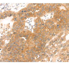 Immunohistochemistry - TMEFF2 Antibody from Signalway Antibody (40252) - Antibodies.com