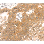 Immunohistochemistry - TMEFF2 Antibody from Signalway Antibody (40252) - Antibodies.com