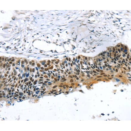 Immunohistochemistry - TRERF1 Antibody from Signalway Antibody (40264) - Antibodies.com