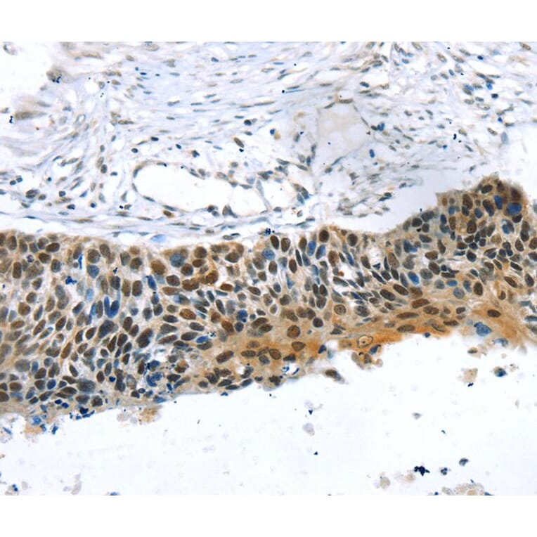 Immunohistochemistry - TRERF1 Antibody from Signalway Antibody (40264) - Antibodies.com