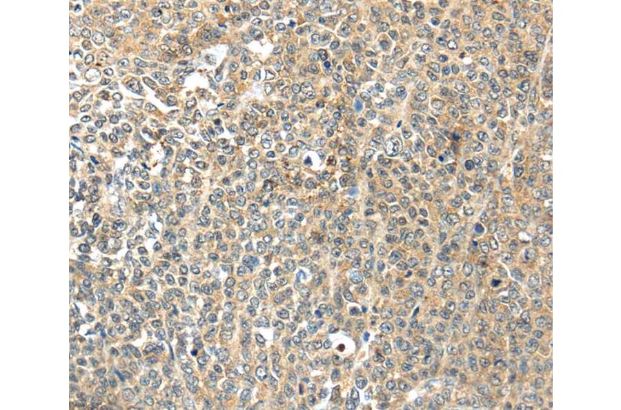 Immunohistochemistry - TSPYL6 Antibody from Signalway Antibody (40269) - Antibodies.com