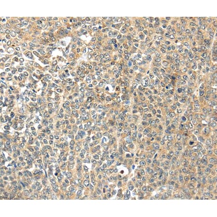 Immunohistochemistry - TSPYL6 Antibody from Signalway Antibody (40269) - Antibodies.com