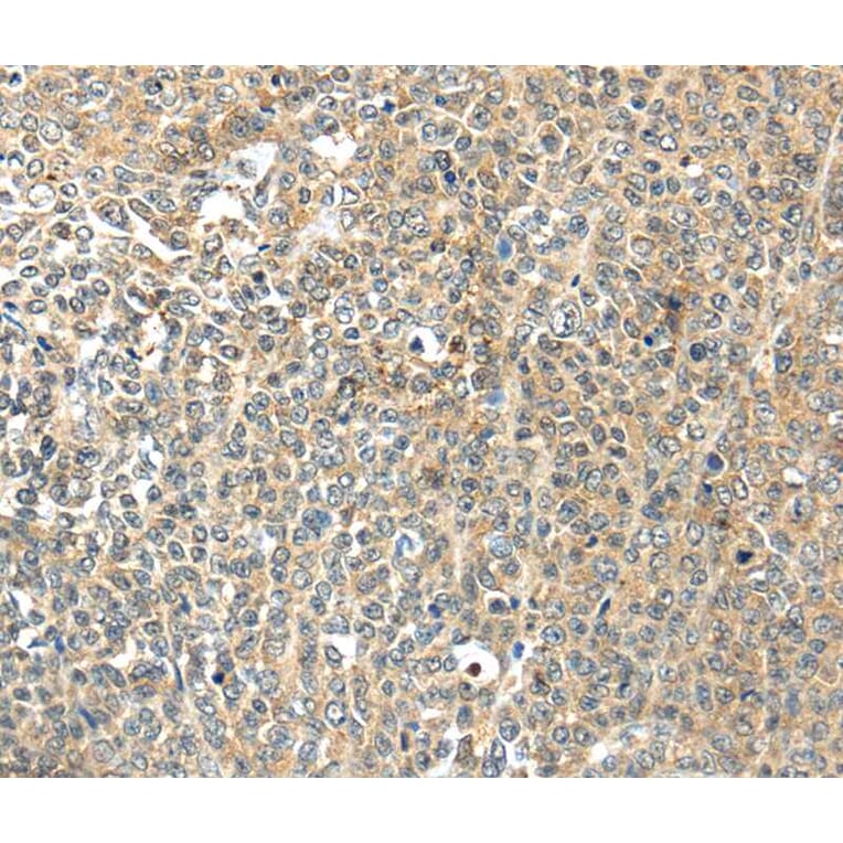 Immunohistochemistry - TSPYL6 Antibody from Signalway Antibody (40269) - Antibodies.com