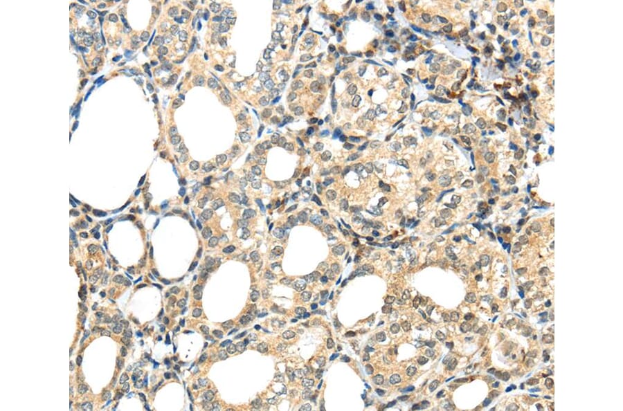 Immunohistochemistry - TSPYL6 Antibody from Signalway Antibody (40269) - Antibodies.com