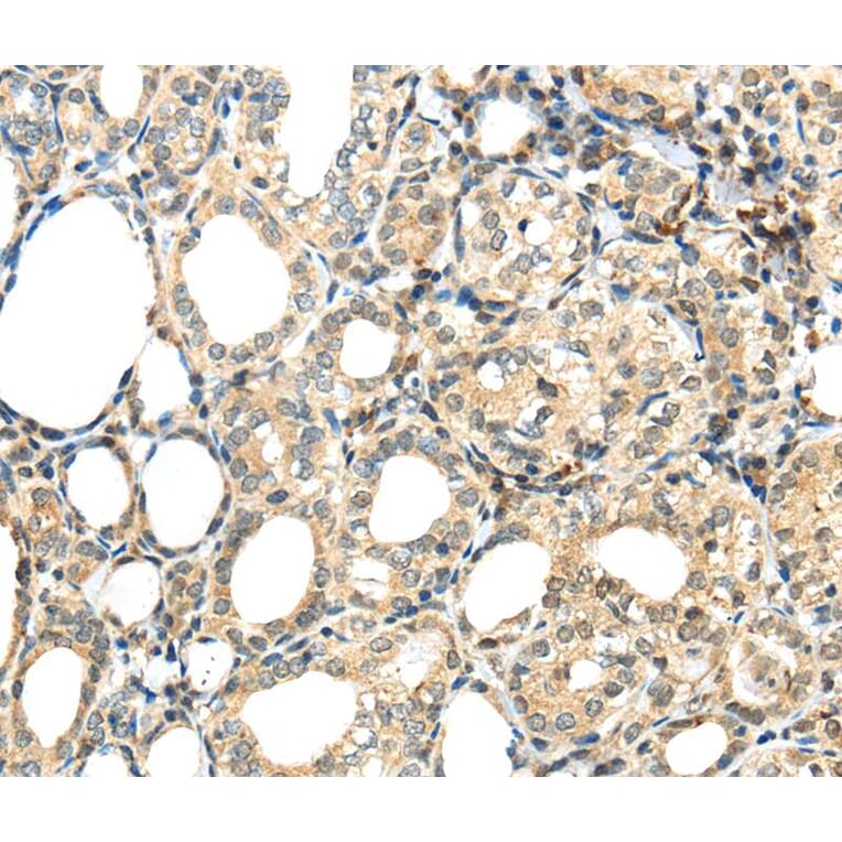 Immunohistochemistry - TSPYL6 Antibody from Signalway Antibody (40269) - Antibodies.com