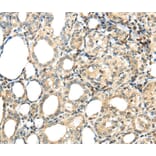 Immunohistochemistry - TSPYL6 Antibody from Signalway Antibody (40269) - Antibodies.com