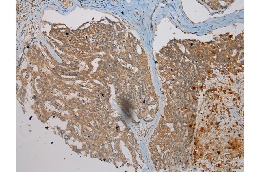 Immunohistochemistry - WDR45B Antibody from Signalway Antibody (40298) - Antibodies.com