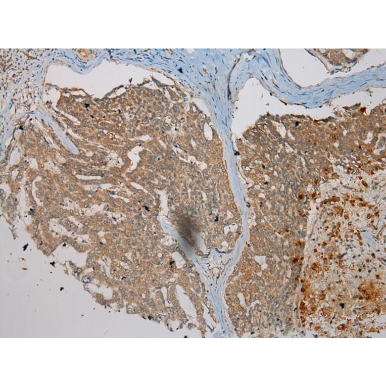 Immunohistochemistry - WDR45B Antibody from Signalway Antibody (40298) - Antibodies.com