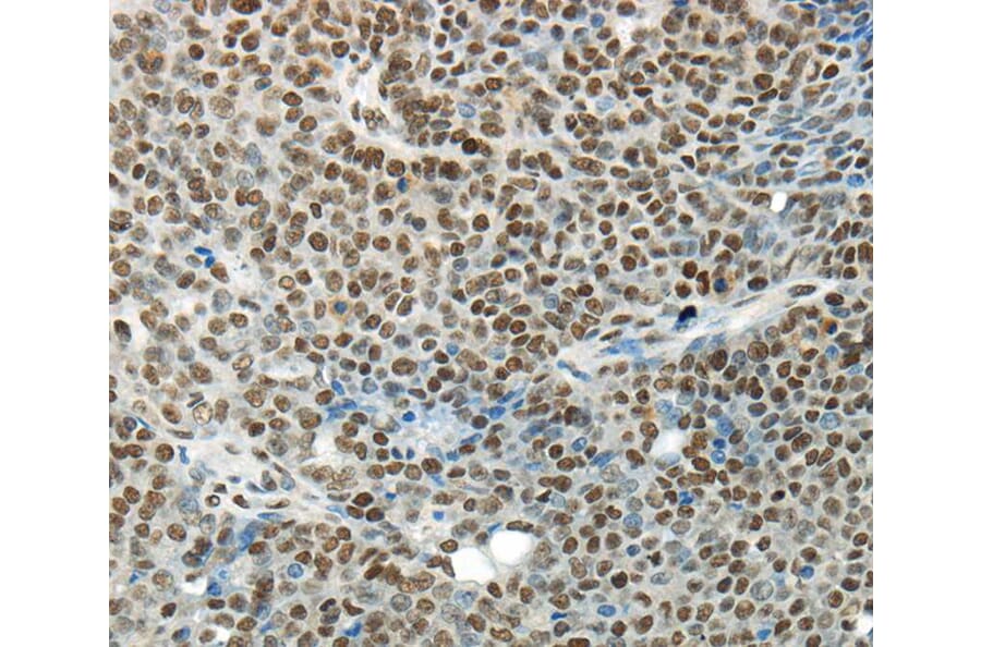 Immunohistochemistry - HNRNPM Antibody from Signalway Antibody (40303) - Antibodies.com