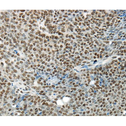 Immunohistochemistry - HNRNPM Antibody from Signalway Antibody (40303) - Antibodies.com
