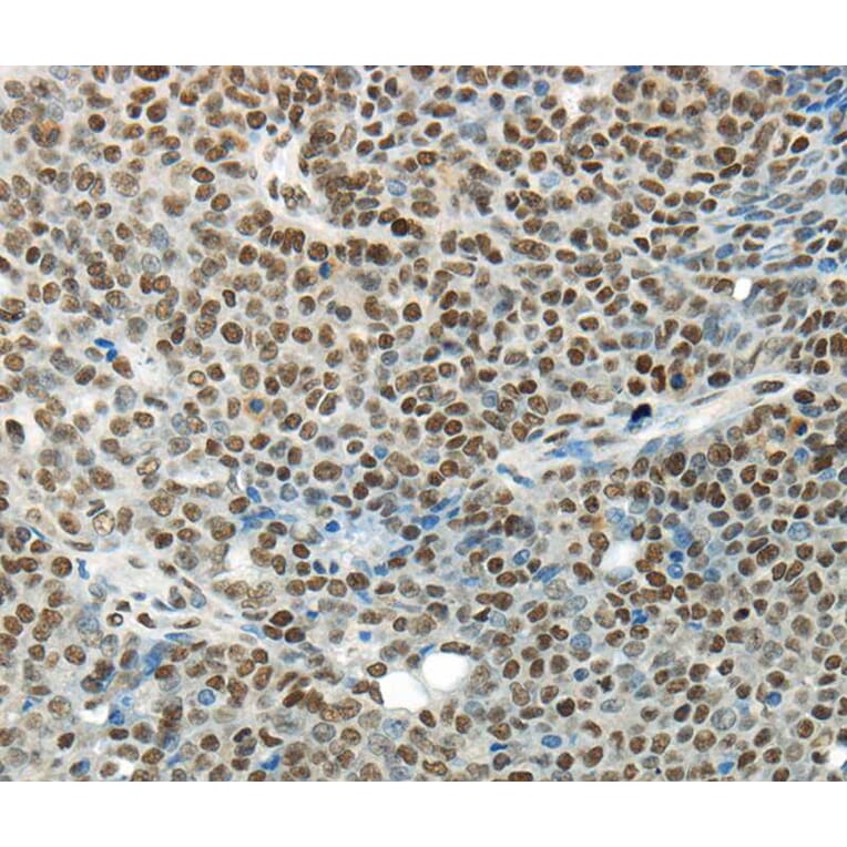 Immunohistochemistry - HNRNPM Antibody from Signalway Antibody (40303) - Antibodies.com