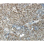 Immunohistochemistry - HNRNPM Antibody from Signalway Antibody (40303) - Antibodies.com