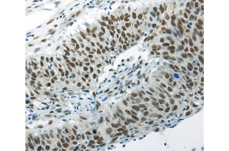 Immunohistochemistry - HNRNPM Antibody from Signalway Antibody (40303) - Antibodies.com