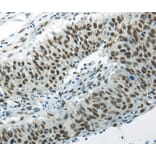 Immunohistochemistry - HNRNPM Antibody from Signalway Antibody (40303) - Antibodies.com