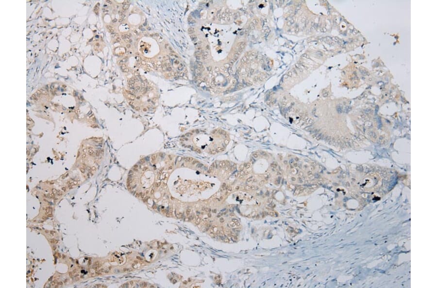 Immunohistochemistry - RASSF3 Antibody from Signalway Antibody (40318) - Antibodies.com
