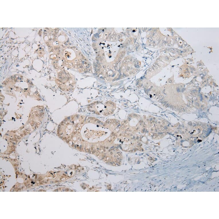 Immunohistochemistry - RASSF3 Antibody from Signalway Antibody (40318) - Antibodies.com
