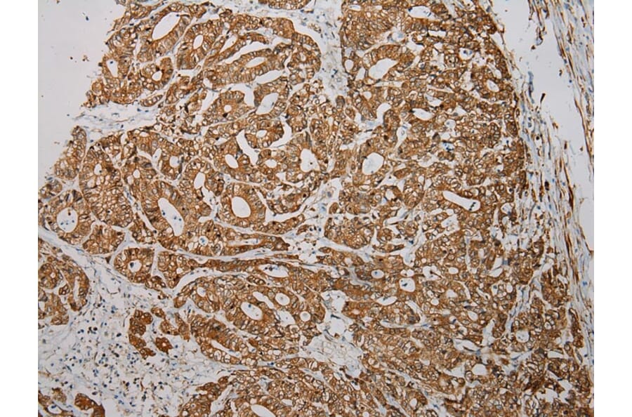 Immunohistochemistry - TXNDC5 Antibody from Signalway Antibody (40350) - Antibodies.com