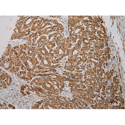 Immunohistochemistry - TXNDC5 Antibody from Signalway Antibody (40350) - Antibodies.com