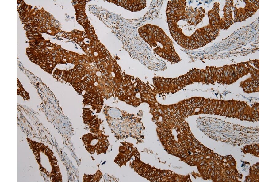 Immunohistochemistry - TXNDC5 Antibody from Signalway Antibody (40350) - Antibodies.com