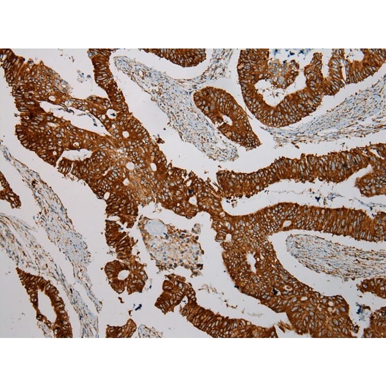 Immunohistochemistry - TXNDC5 Antibody from Signalway Antibody (40350) - Antibodies.com