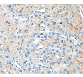 Immunohistochemistry - TNFSF4 Antibody from Signalway Antibody (40355) - Antibodies.com