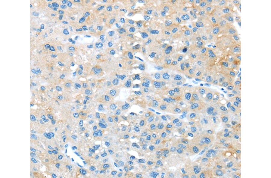 Immunohistochemistry - TNFSF4 Antibody from Signalway Antibody (40355) - Antibodies.com