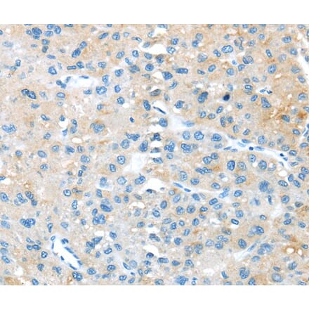 Immunohistochemistry - TNFSF4 Antibody from Signalway Antibody (40355) - Antibodies.com