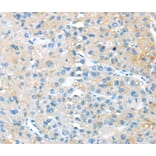 Immunohistochemistry - TNFSF4 Antibody from Signalway Antibody (40355) - Antibodies.com