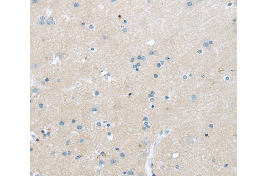 Immunohistochemistry - TNFSF4 Antibody from Signalway Antibody (40355) - Antibodies.com