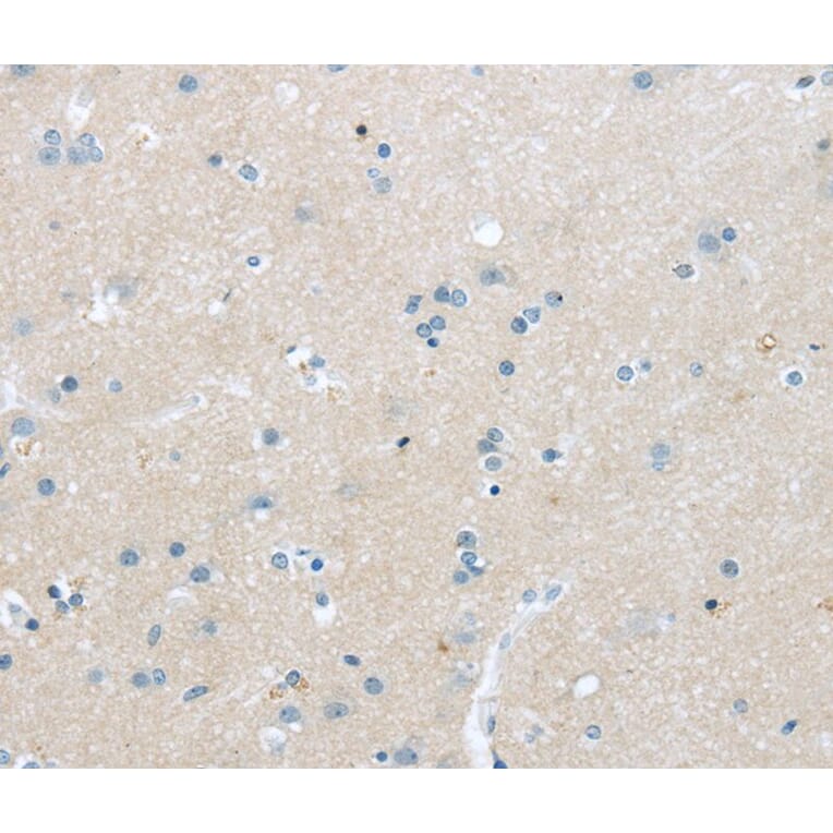 Immunohistochemistry - TNFSF4 Antibody from Signalway Antibody (40355) - Antibodies.com