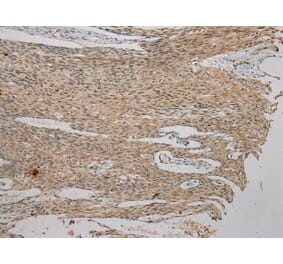 Immunohistochemistry - AGPAT9 Antibody from Signalway Antibody (40363) - Antibodies.com