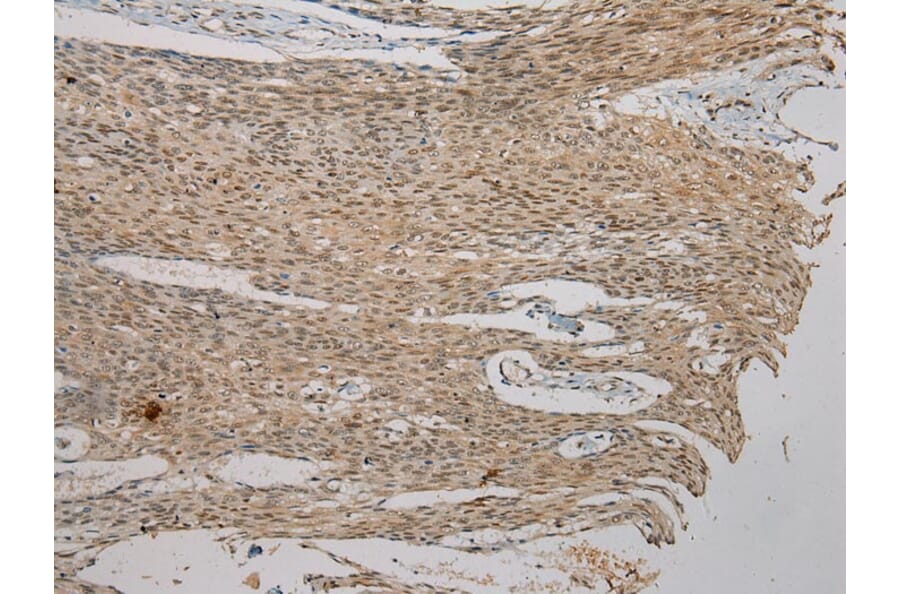 Immunohistochemistry - AGPAT9 Antibody from Signalway Antibody (40363) - Antibodies.com