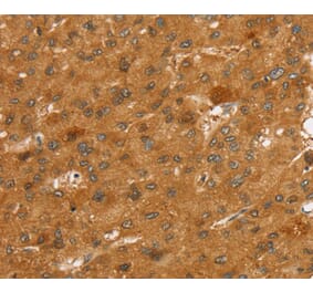 Immunohistochemistry - SLC7A9 Antibody from Signalway Antibody (40371) - Antibodies.com