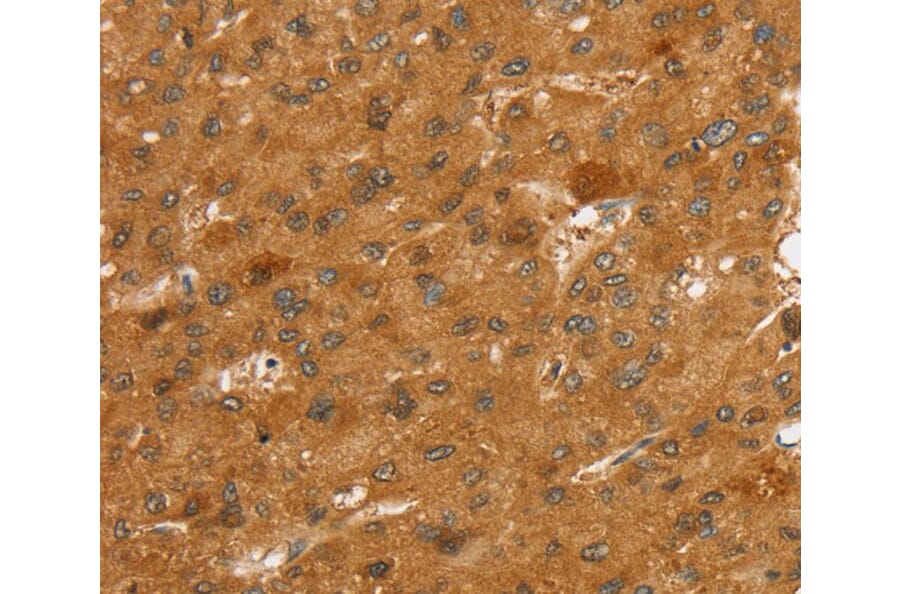 Immunohistochemistry - SLC7A9 Antibody from Signalway Antibody (40371) - Antibodies.com