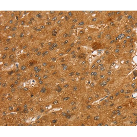 Immunohistochemistry - SLC7A9 Antibody from Signalway Antibody (40371) - Antibodies.com