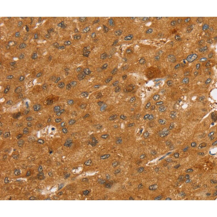 Immunohistochemistry - SLC7A9 Antibody from Signalway Antibody (40371) - Antibodies.com