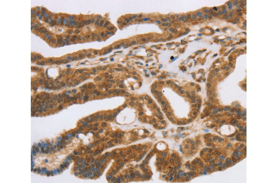 Immunohistochemistry - SLC7A9 Antibody from Signalway Antibody (40371) - Antibodies.com
