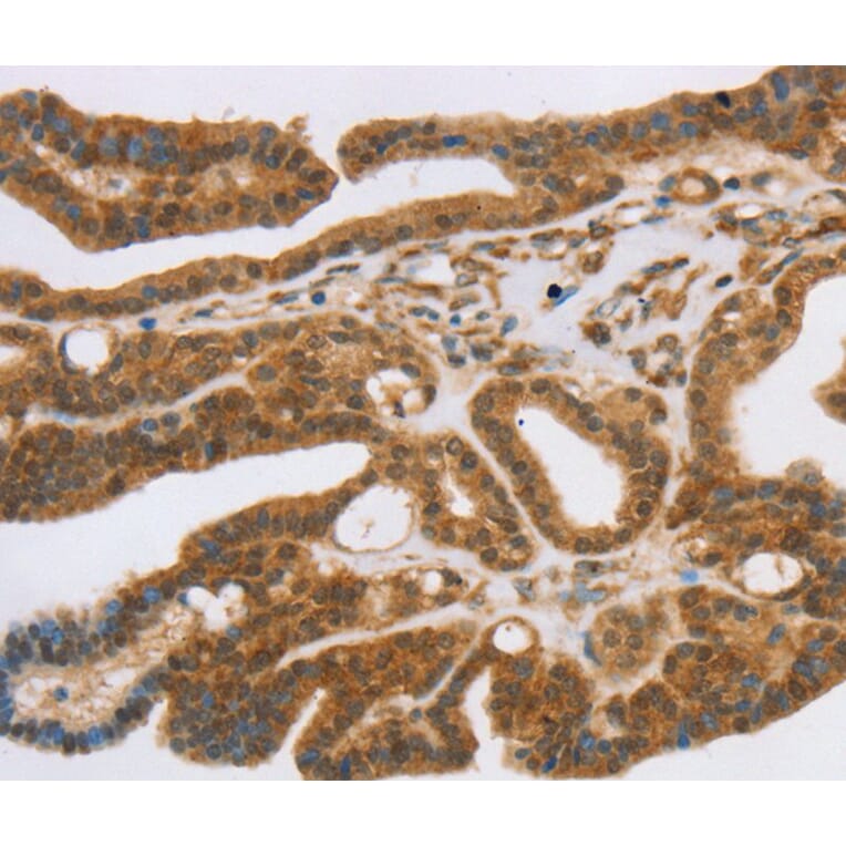 Immunohistochemistry - SLC7A9 Antibody from Signalway Antibody (40371) - Antibodies.com