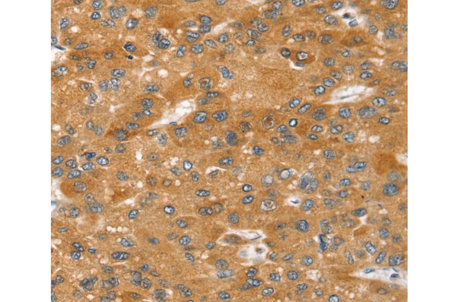 Immunohistochemistry - SRGAP2 Antibody from Signalway Antibody (40373) - Antibodies.com