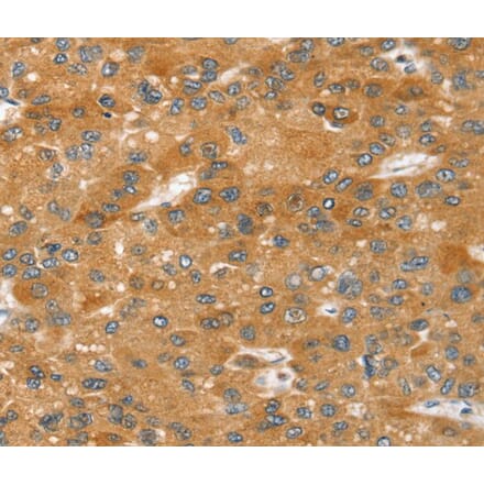 Immunohistochemistry - SRGAP2 Antibody from Signalway Antibody (40373) - Antibodies.com