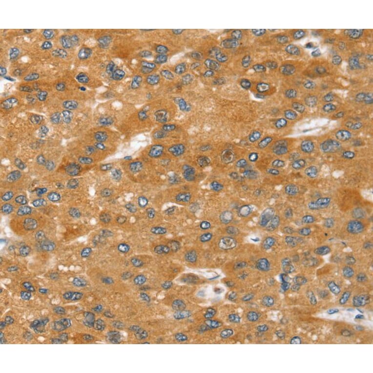 Immunohistochemistry - SRGAP2 Antibody from Signalway Antibody (40373) - Antibodies.com