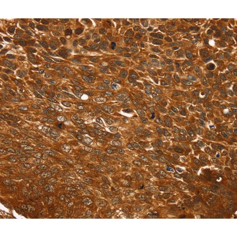 Immunohistochemistry - TCEB3B Antibody from Signalway Antibody (40379) - Antibodies.com