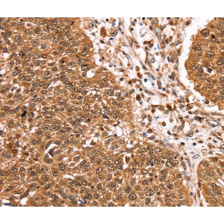 Immunohistochemistry - TCEB3B Antibody from Signalway Antibody (40379) - Antibodies.com